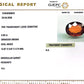 Siloni Gomed Gemstone – Natural Hessonite for Rahu Protection & Success 5.09 CT