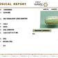 Australian Opal – The Gem of Radiant Fire, Rarity & Intuition 4.63 CT
