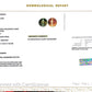 Natural Cat’s Eye Gemstone (Lehsunia) – Protection, Intuition & Ketu’s Power 8.83 CT