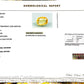 Natural Yellow Sapphire (Pukhraj) – Prosperity, Wisdom & Jupiter’s Blessing 8.24 CT