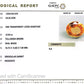 Siloni Gomed Gemstone – Natural Hessonite for Rahu Protection & Success 12.83 CT