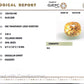 Siloni Gomed Gemstone – Natural Hessonite for Rahu Protection & Success 3.63 CT