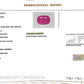 Natural Mozambique Ruby 4.77 Ct Certified